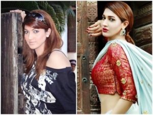 Sana Fakhar Before and After Surgery