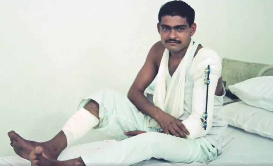 19 years old Yogendra Singh Yadav at the Army Hospital, Delhi