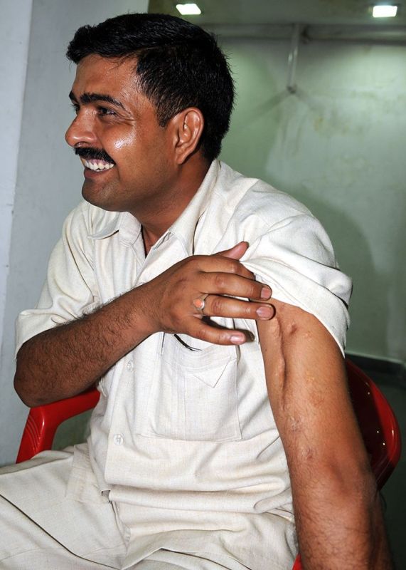 Subedar Major Yogendra Singh Yadav showing the scars of bullets on his arm that he has had received during the Tiger Hill battle