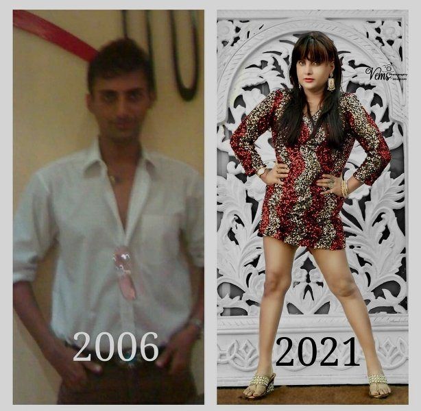 Naaz Joshi before and after the sex reassignment surgery