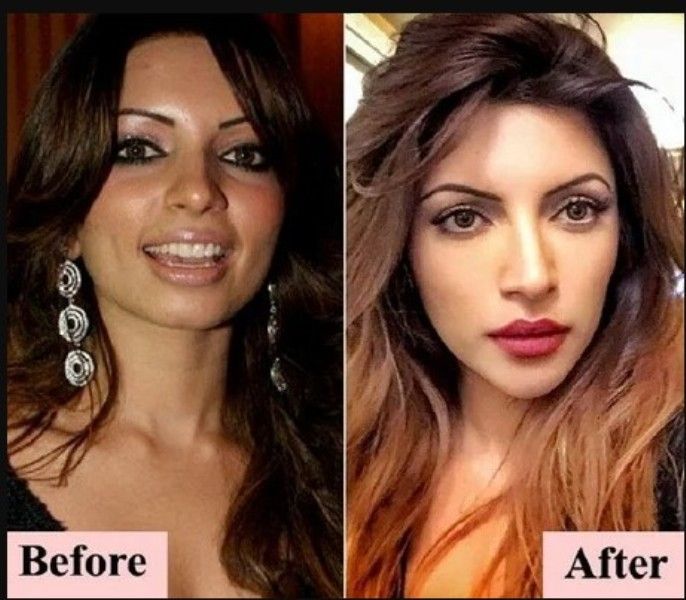 Shama Sikander’s before and after picture