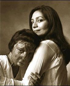 Tehmina Durrani with acid attack victim, Fakra Younus