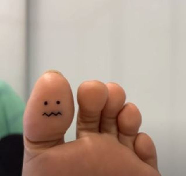 A grumpy face tattoo on the right foot's thumb