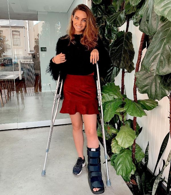 Sarah Todd when her ankle broke during Covid-19 lockdown