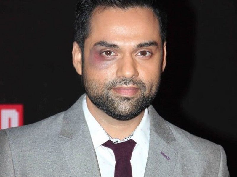 A picture of Abhay Deol showcasing his black eye at Screen Awards (2014)