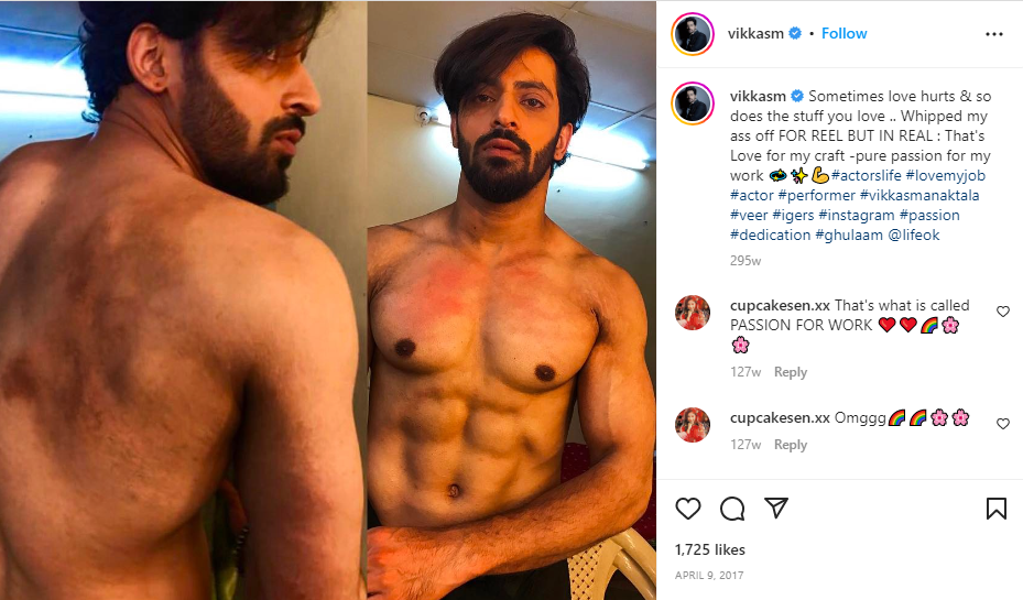 Vikas Manaktala's Instagram post showcasing the bruises on his body after shooting for the TV show Ghulaam (2017)
