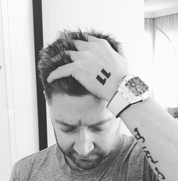 Michael Clarke showing stitches in his forehead after surgery to treat Skin Cancer