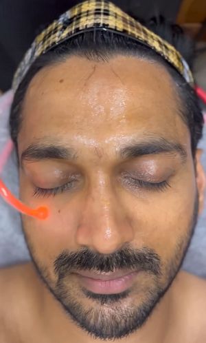 Arnav SKin Treatment