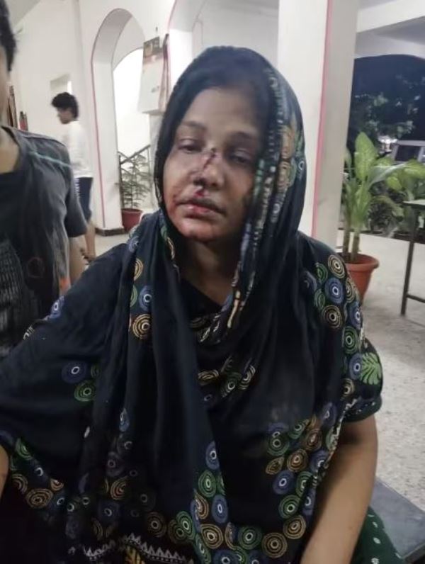 Mansoor Ali Khan's third wife, Waheeda, bleeding after a family dispute in 2018